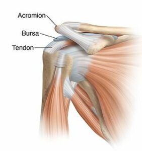 Shoulder Impingement - Shoulder And Knee Clinic