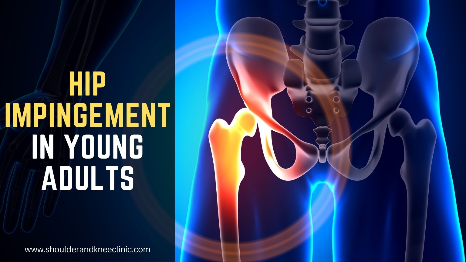 Hip Impingement in Young Adults: Why Early Diagnosis Matters