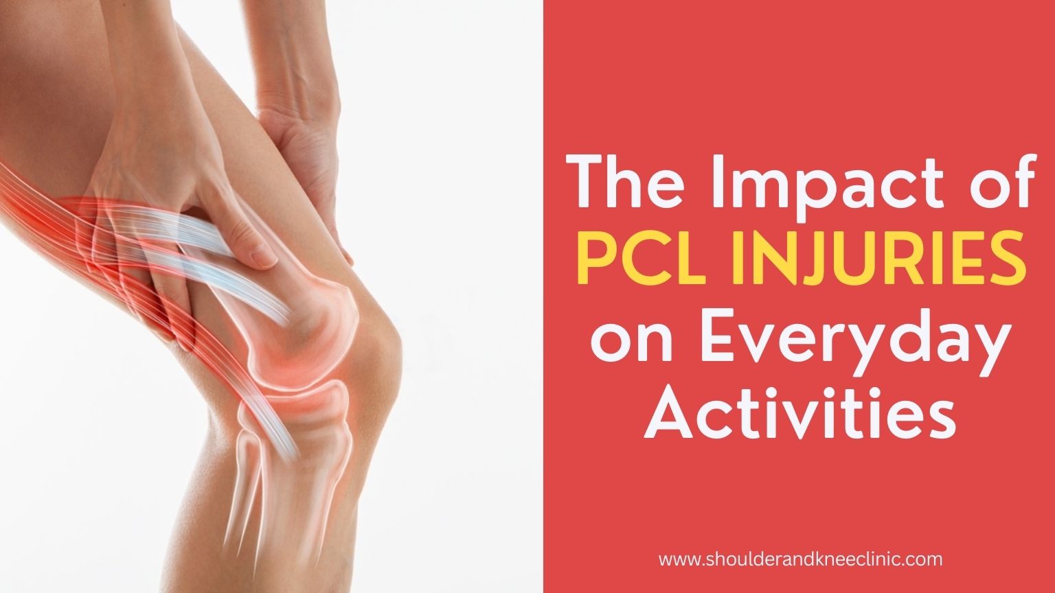 The Impact of PCL Injuries on Everyday Activities